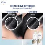 Dove Triple Dandruff Care Shampoo 400ml - Image 5