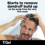 Neutrogena T/Gel Anti-Dandruff Shampoo for Dry Hair 125ml - Image 3