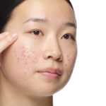 The Ordinary Aloe 2% + NAG 2% Solution 30ml - Image 3