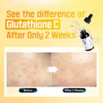 numbuzin No.5 Vitamin Concentrated Serum - Image 5