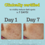 Chemist At Play 10% Vitamin C Face Serum for Glowing & Bright Skin-30ml - Image 10