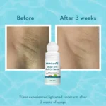 WishCare Under Arm Roll On Serum | 50ml - Image 5